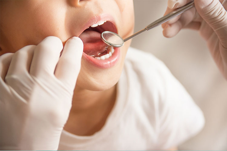 小児歯科：イメージ画像
